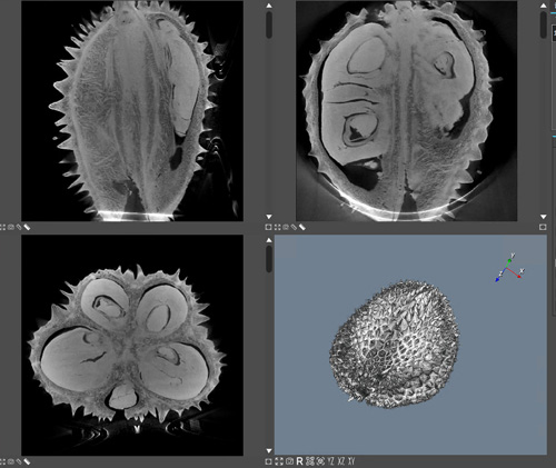 X-RAY CT FOR DUIRAN